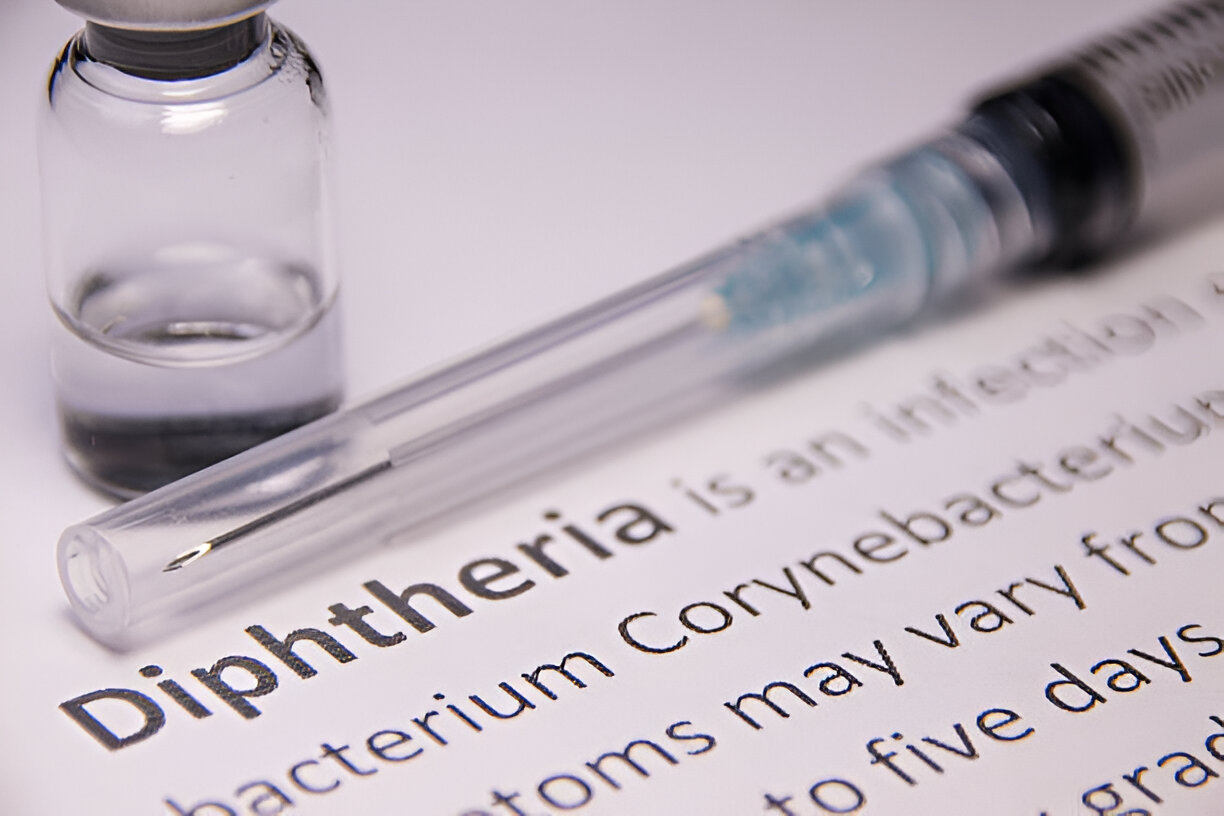 Diphtheria